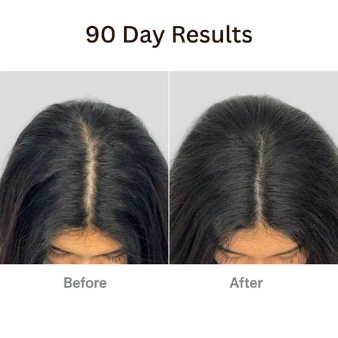 TheraBrush™ The Natural 4in1 Hair Restoring Brush